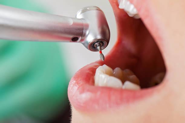 Best Pediatric Emergency Dentist in Versailles, KY